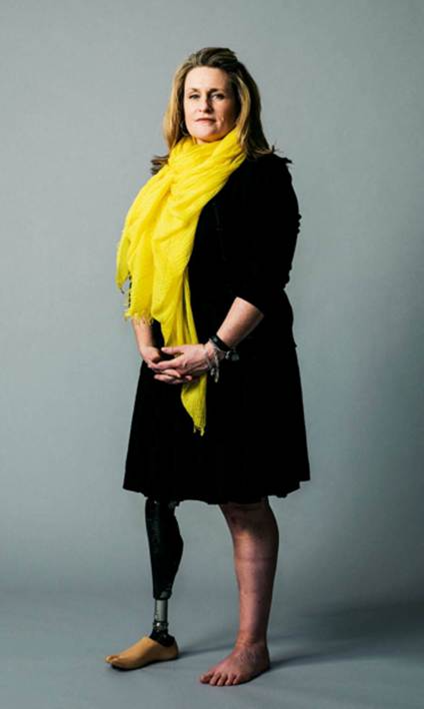 Boston Marathon Bombing Survivor Roseann Sdoia Materia